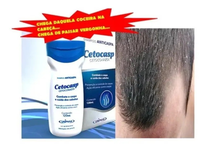 Shampoo Anticaspa Cetocasp 120mL Uniphar